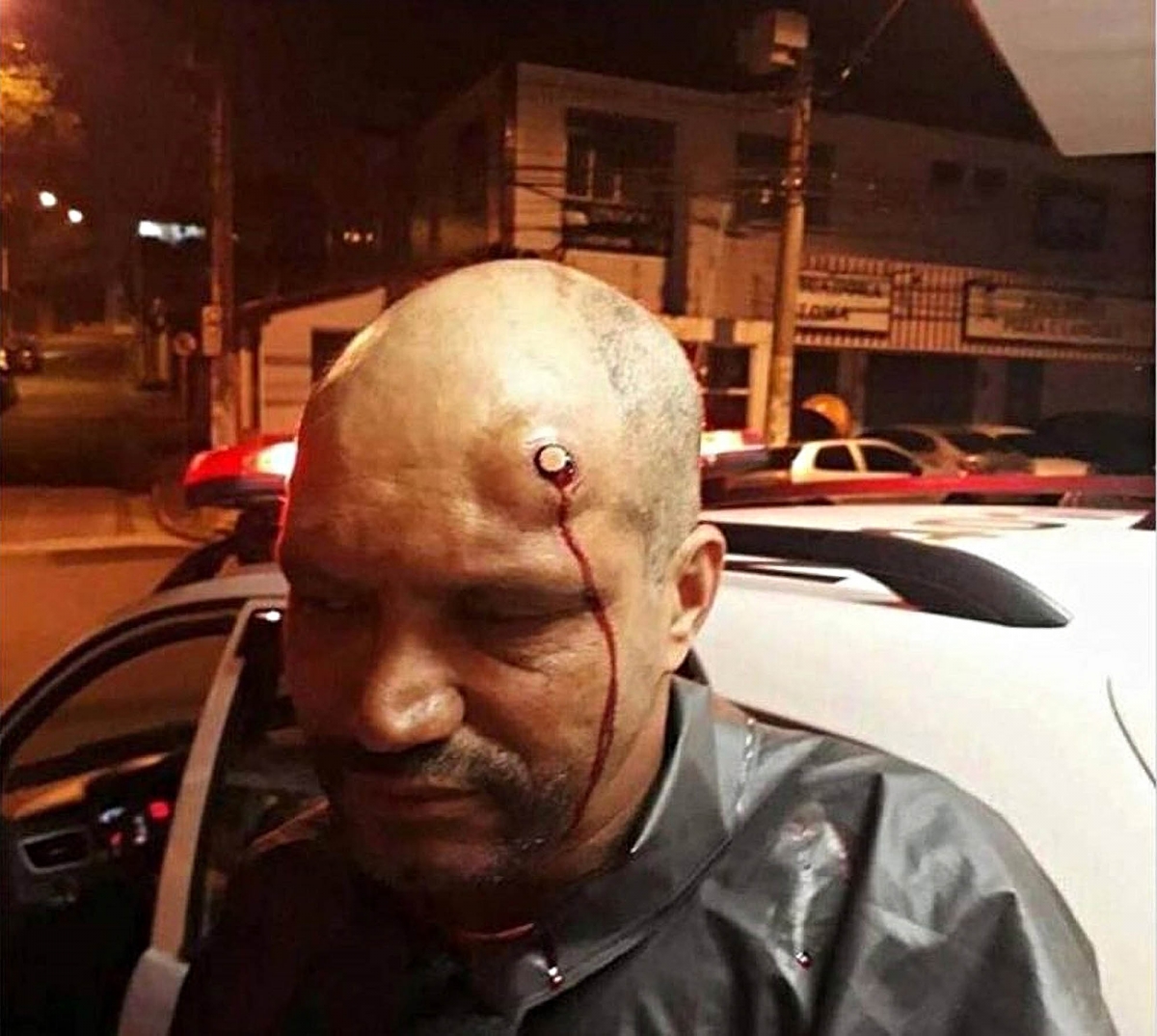 Man survives an Head Shot!